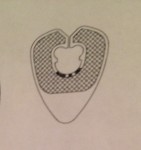 Picture for patent available