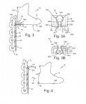 Patent for sale.