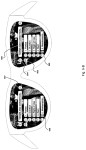 Picture for patent available