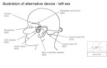 Picture for patent available