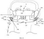 Picture for patent available