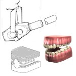 Picture for patent available